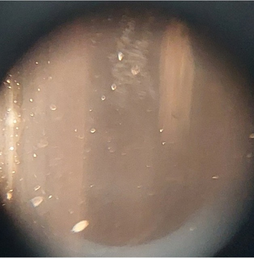 ESM触媒水 3年後 顕微鏡写真