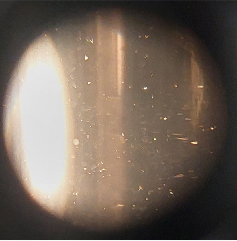 ESM触媒水 初期 顕微鏡写真